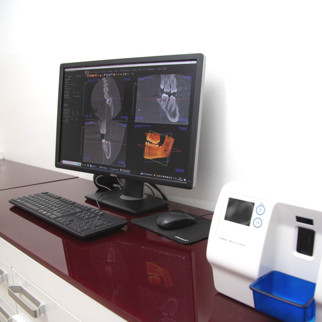 Dentista a Mendrisio Dott. Antonio De Francesco